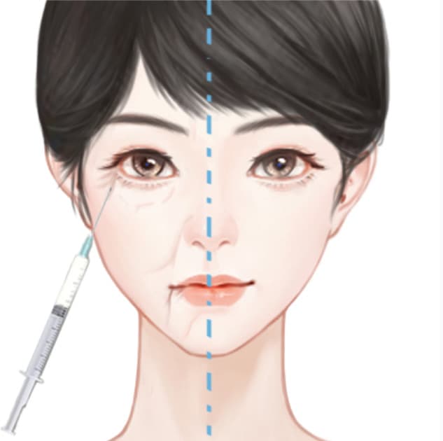 胶原蛋白淡化面部细纹