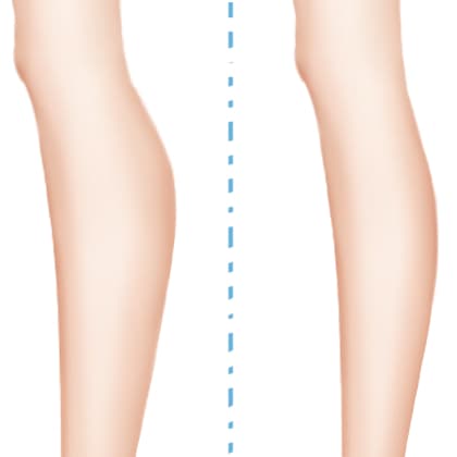 隔空溶脂瘦小腿