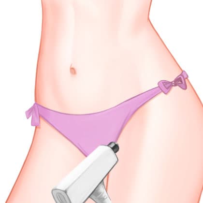 比基尼线脱毛